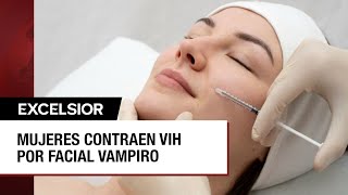 Mujeres contraen VIH al someterse al facial vampiro contra envejecimiento