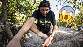 Thumbnail image for ME HE TORCIDO EL PIE!