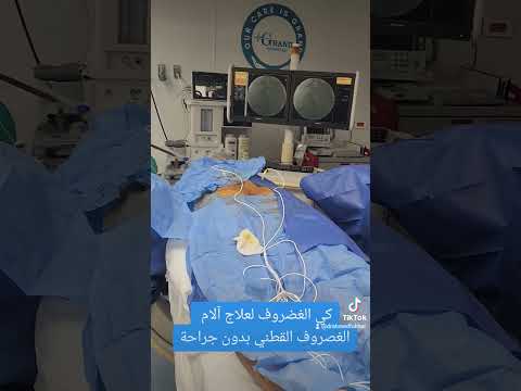 كي نواة الغضروف بالتردد الحراري لعلاج آلام الغضروف بدون جراحة انزلاق انزلاق غضروفي