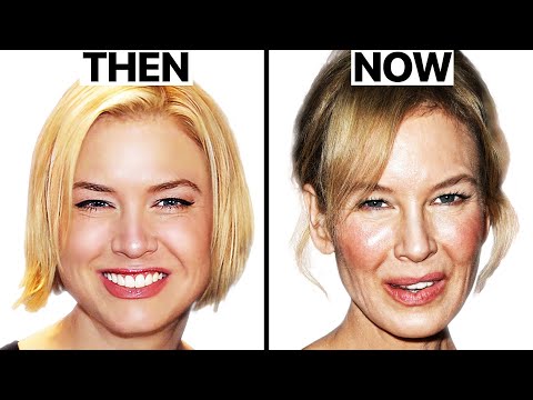 Video: Rene Zellweger before and after plastic surgery: comparison