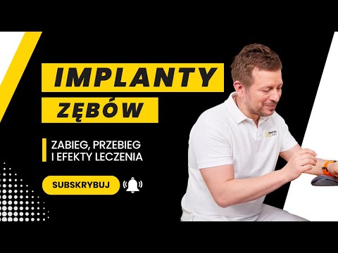 Wideo: Biohakerzy Wszczepili Implanty Z Diodami LED Pod Skórą - Alternatywny Widok