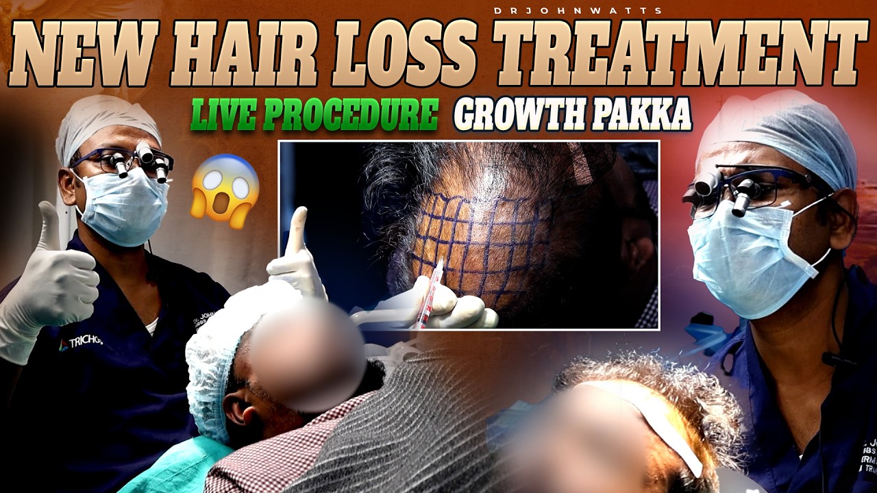 Exosome Preparation and Intradermal Injection Protocol for Hair Restoration