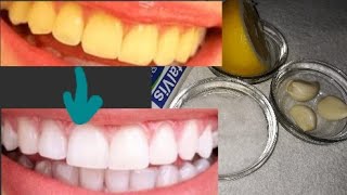 تبيض الأسنان بمكونات طبيعية