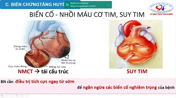 Đánh giá huyết áp theo who năm 2024