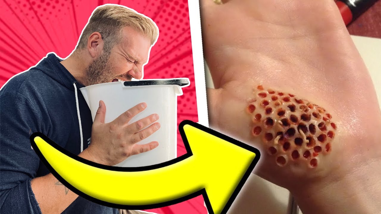 10 FARLIGSTE insekter med @TænkeHatten