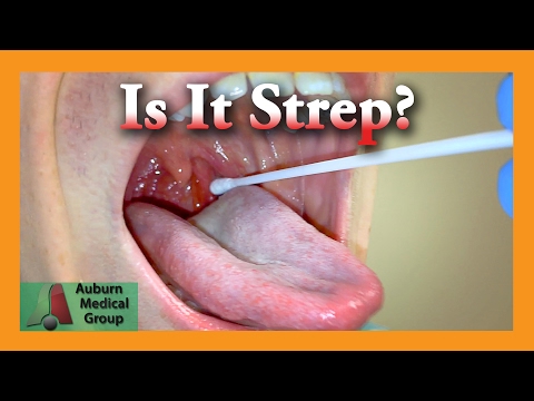 Is it Strep Throat? | Auburn Medical Group