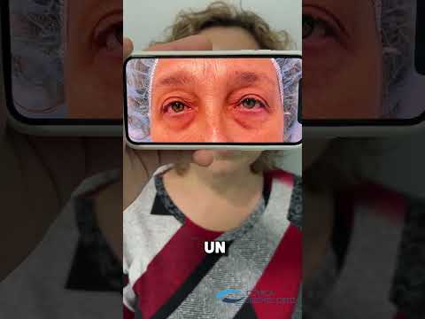 Miniatura del vídeo de un caso real de la Clínica Jiménez Ortiz