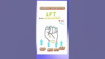 LFT Mnemonic in liver  disease