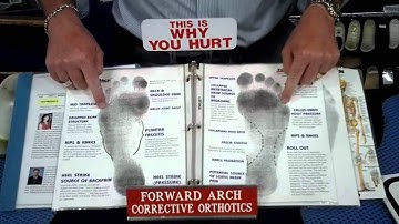 Forward Arch Corrective Orthotics Arch Support for Foot Pain