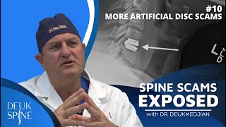 More Artificial Disc Scams on Facebook | (Ep:10 Spine Scams Exposed)