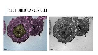 Coloring Electron Micrographs