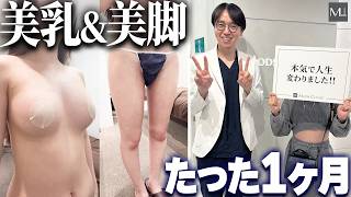 ヌーブラで誤魔化していたバストが脂肪豊胸で2カップUP！？細…のサムネイル