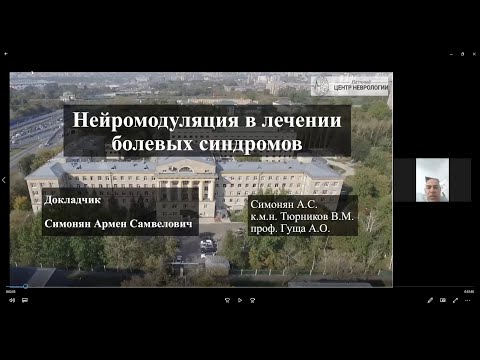 Нейромодуляция в лечении Болевых синдромов