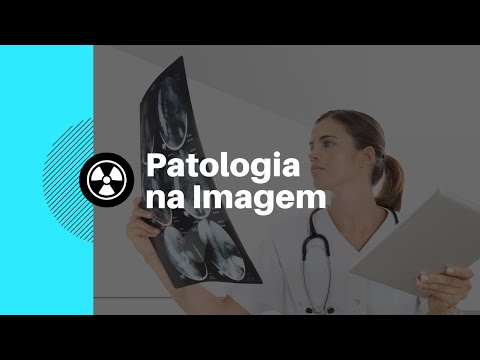 PATOLOGIA NA IMAGEM - PATOLOGIAS DO ABDOME