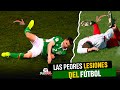 Las peores lesiones del fútbol.