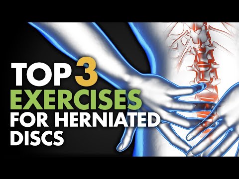 Top 3 Exercises For Herniated Discs