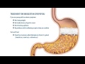 Gerd Blood In Stool