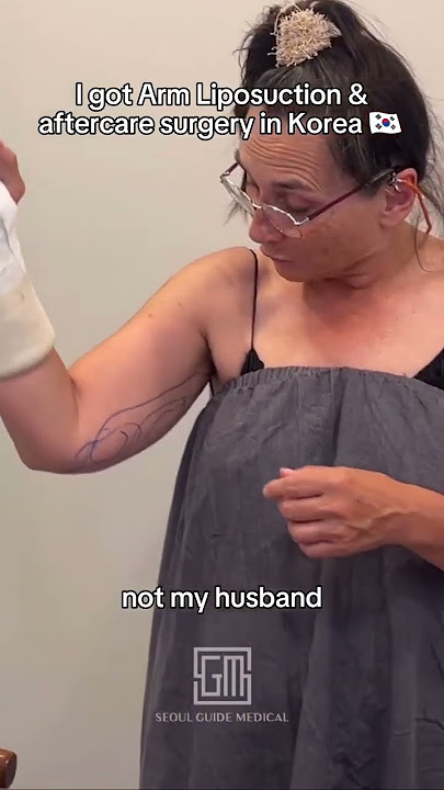 그녀는 한국에서 팔 지방 흡입술과 전체 사후 관리 수술을 받았습니다.🇰🇷