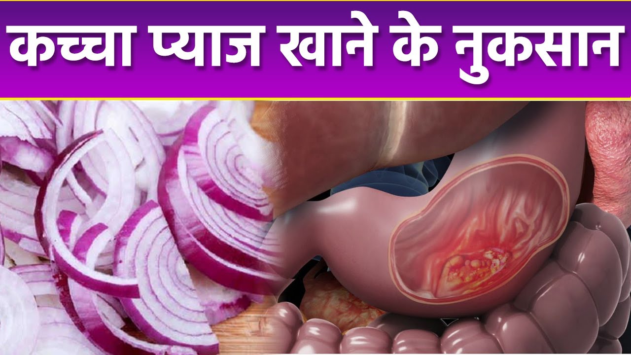 कच्चा प्याज खाने के नुकसान Kacha Pyaz Khane Ke Nuksan Boldsky