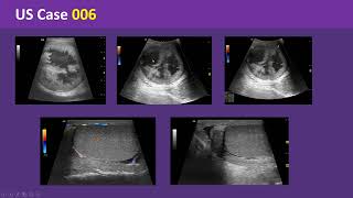 Interesting Ultrasound Case 6