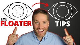 Eye Floaters Help! - 5 Natural Life Hack Remedies For Adapting To Eye Floaters screenshot 2