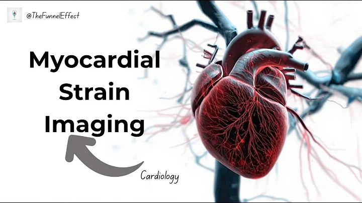Myocardial Strain Imaging