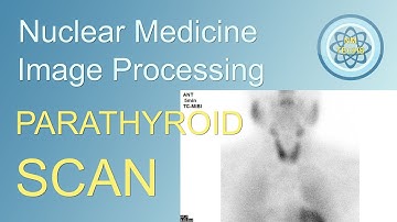 Parathyroid scan Processing, in nuclear medicine