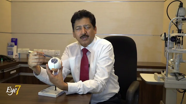 What is the difference between Intra - Ocular Lens (IOL) and ICL? Dr Sanjay Chaudhary