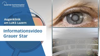 Uniklinik Köln | Augenklinik: Grauer Star OP - Katarakt OP (Patienteninformation)