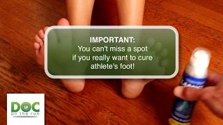 How to treat the foot fungus with topical antifungal