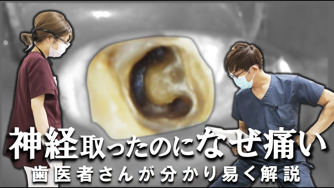 神経を取ったのに痛い…その理由は神経が残っているから？歯医者さんが分かり易く解説します！　#根管治療