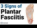 Plantar Fasciitis: 3 signs you may have plantar fasciitis