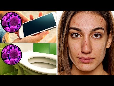Her Cheek Acne Is Gone, after She Started Cleaning Her Smartphone Daily