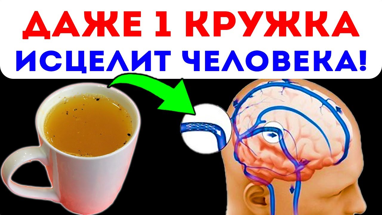 Уже через 7 часов! Разжижает кровь, нормализует артериальное давление ...