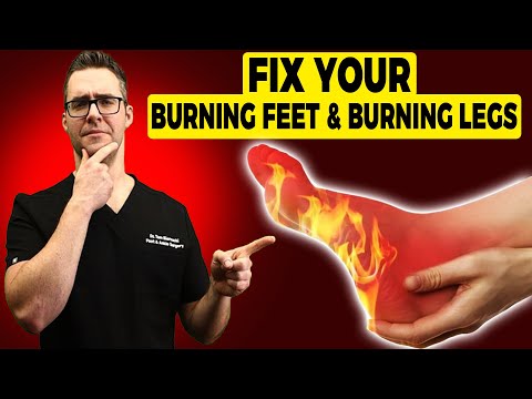 Burning Legs & Burning Feet at Night [Treatment & Home Remedies]