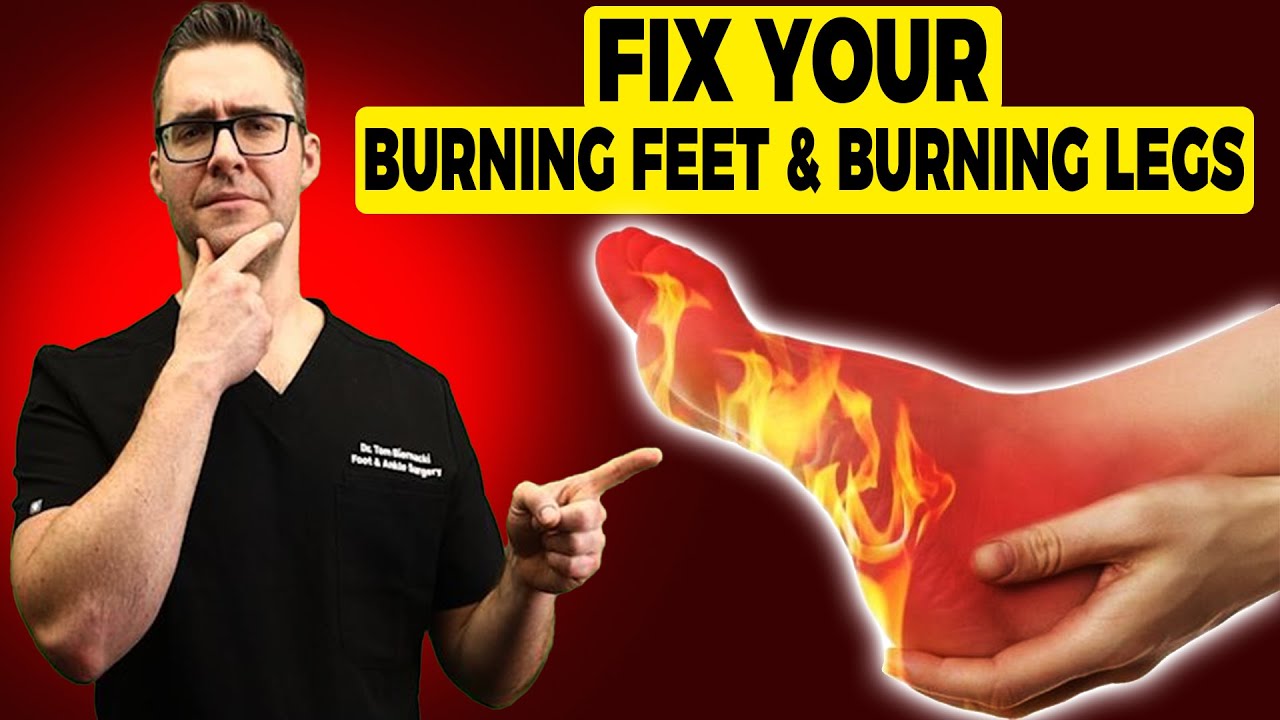 🔥Burning Legs & Burning Feet at Night [Treatment & Home Remedies]🔥