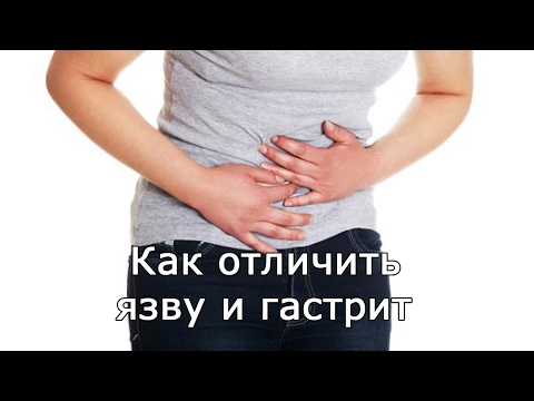 Как отличить язву и гастрит