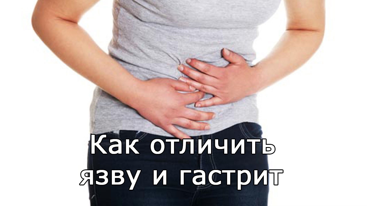 Как отличить язву и гастрит
