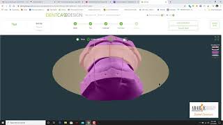 Complete Denture Design with Dentca - Dr. Adarve
