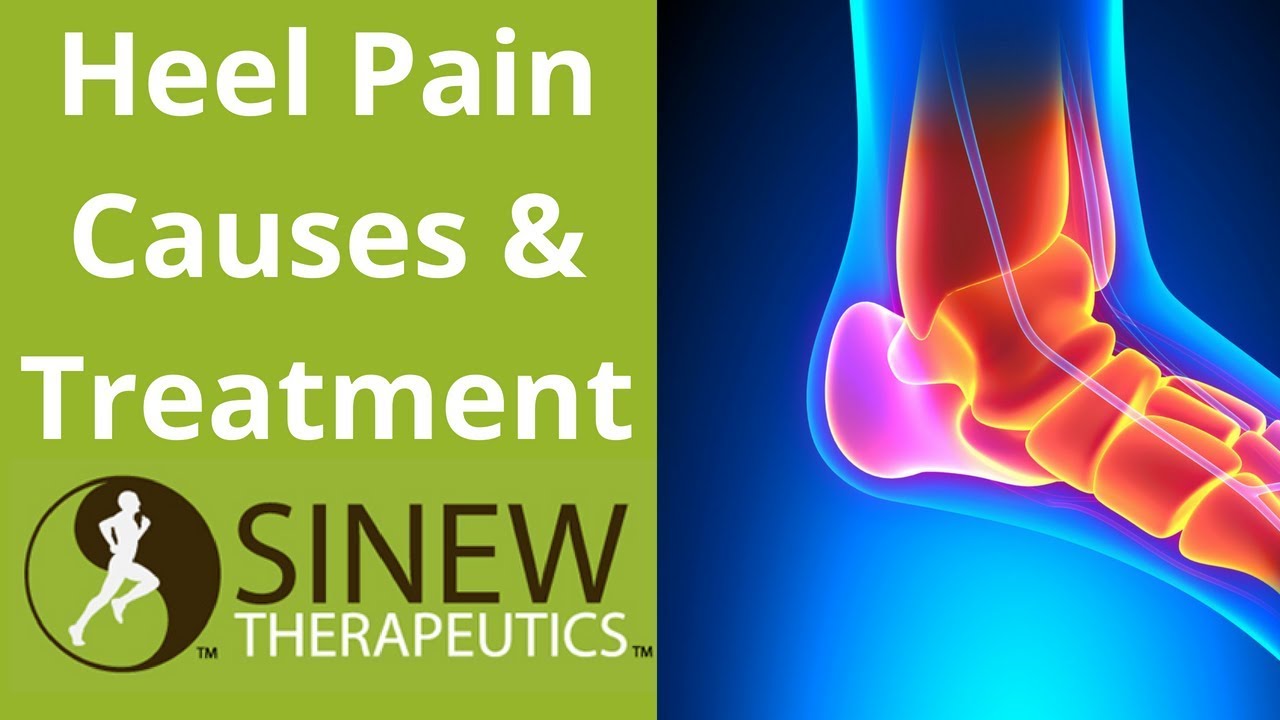 Heel Pain Causes and Treatment YouTube