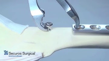 Securos University Tips & Tricks:  Verbrugge