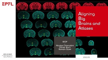Aligning Serial Brain Sections to the Allen Brain Atlas with ABBA