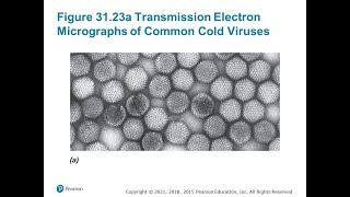 Micro Lecture Ch 31 7