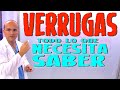 VERRUGAS - Todo lo que necesita saber - Enfermedades #08