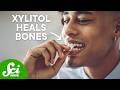 Xylitol: Benefits and Applications