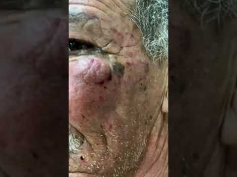 الاعتداء على خالد بومرزاق مدير متوسطة زيان الشريف عبد الحميد تيارت بقضيب حديدي من طرف تلميذ