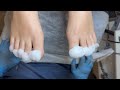 Pedicure | Toe Treatment #asmrvideo #pedicure #nails