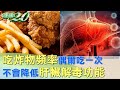 吃炸物頻率偶爾吃一次 不會降低肝臟解毒功能 健康2.0@tvbshealth20