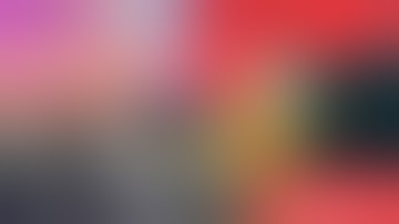 Radius Bone Plating Surgery - Step by step | ORIF with Plating  | Subcutaneous Suturing - Dr Vinoth