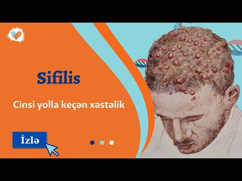 Əsrlərdən bəri insanlıq üçün qorxulu xəstəlik - Sifilis | Sadəcə et: Tibb